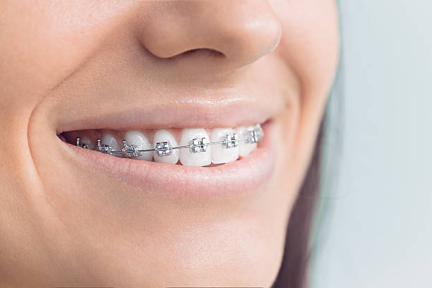 Best Traditional Braces  in Eclectic, AL